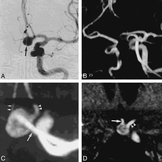 fig 5.