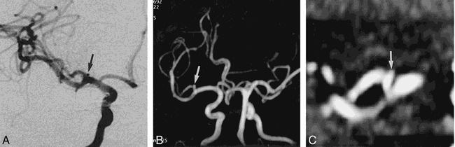 fig 3.