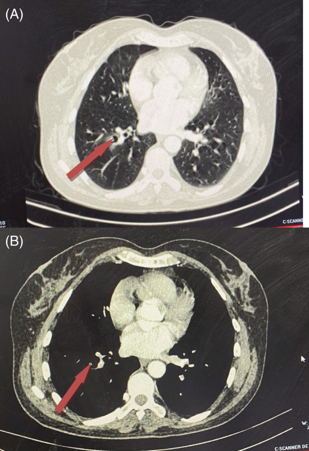 FIGURE 1