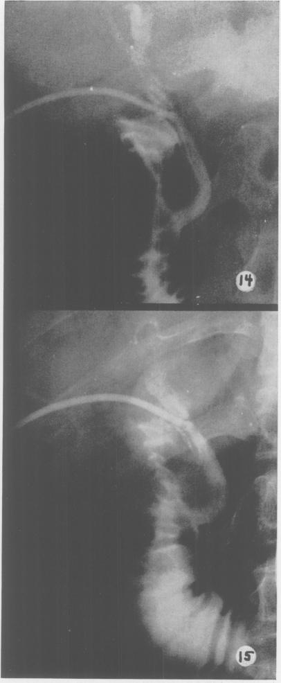 Fig. 14., Fig. 15.