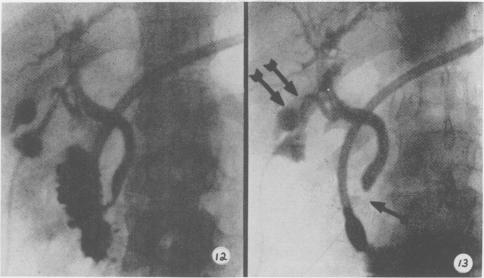 Fig. 12., Fig. 13.