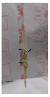 Fig. 4.