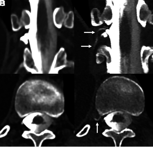 Fig 5.