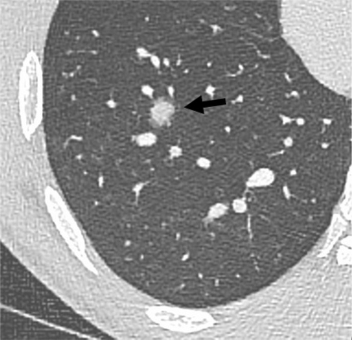 Fig. 5