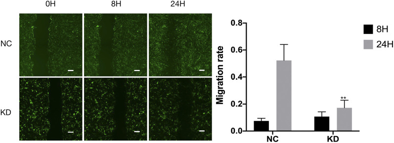 FIGURE 14