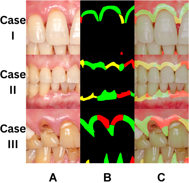 Fig 3