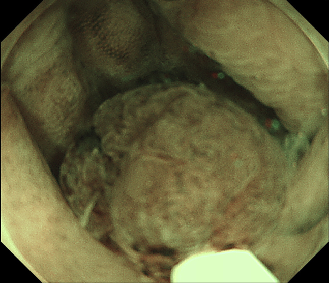 Figure 3