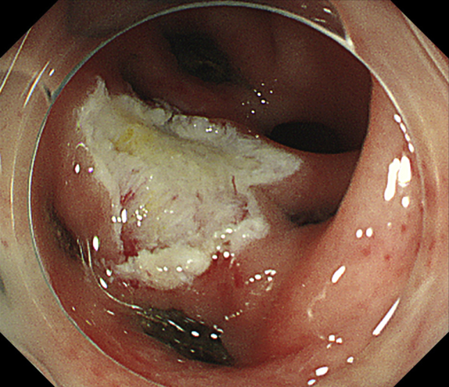 Figure 4