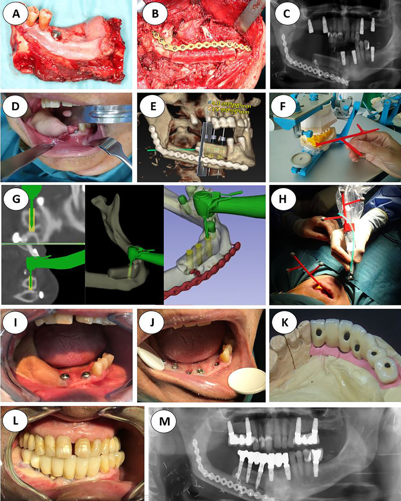 Figure 2