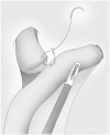 Fig. 11