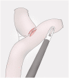 Fig. 14