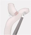 Fig. 13