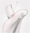 Fig. 15