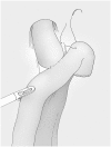 Fig. 16