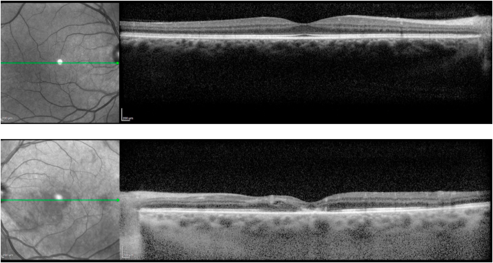 Fig. 4