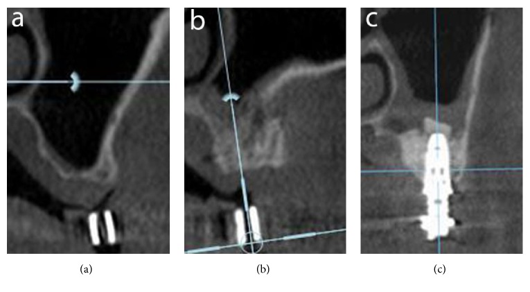 Figure 2