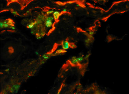 SARS coronavirus (green) in lung cells