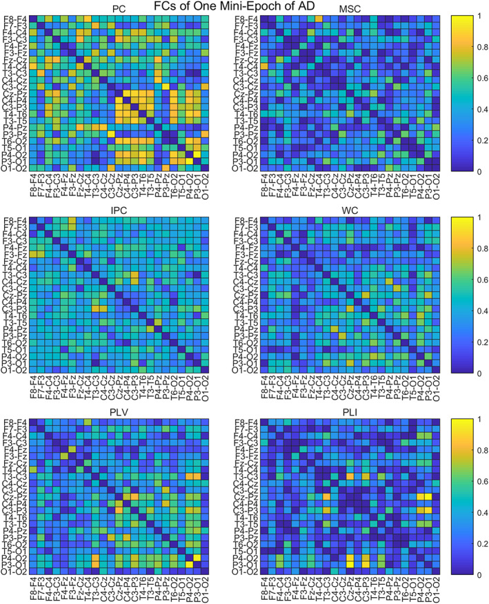 FIGURE 2