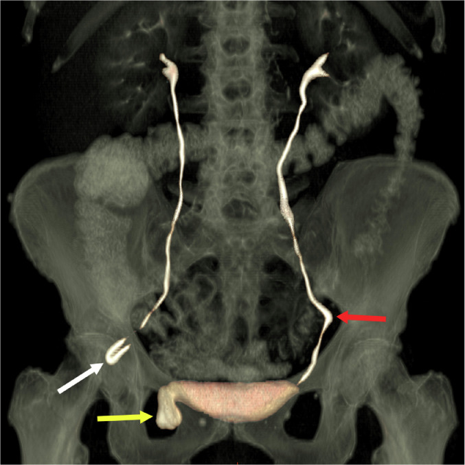 Fig. 1(c)