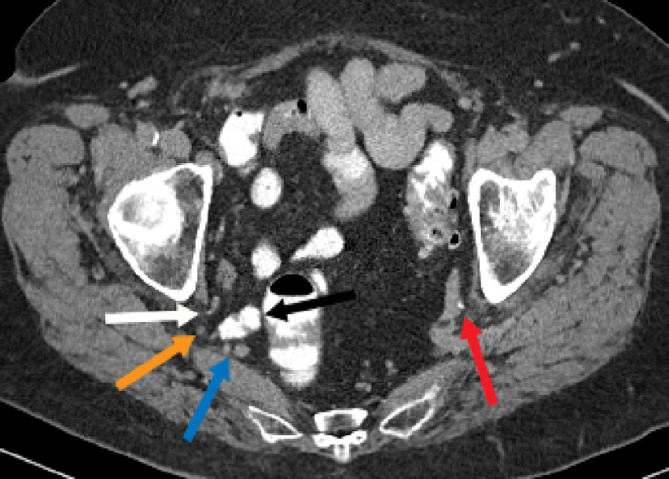 Fig 2