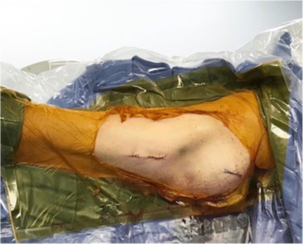 Fig. 10