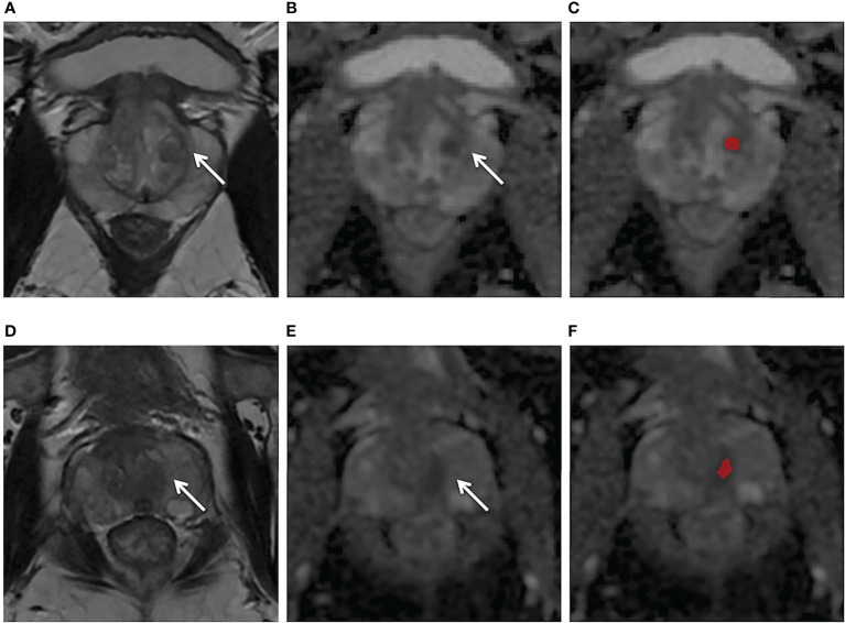 Figure 4