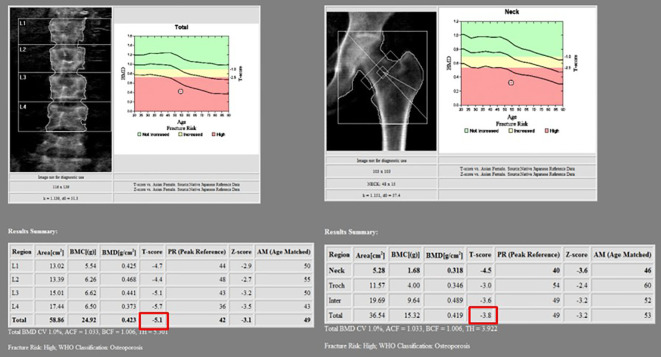 Figure 4