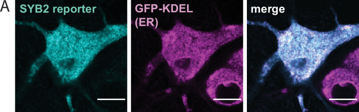 Figure 1—figure supplement 2.