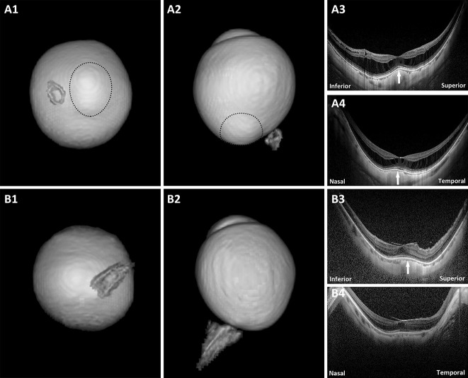 Fig. 2.