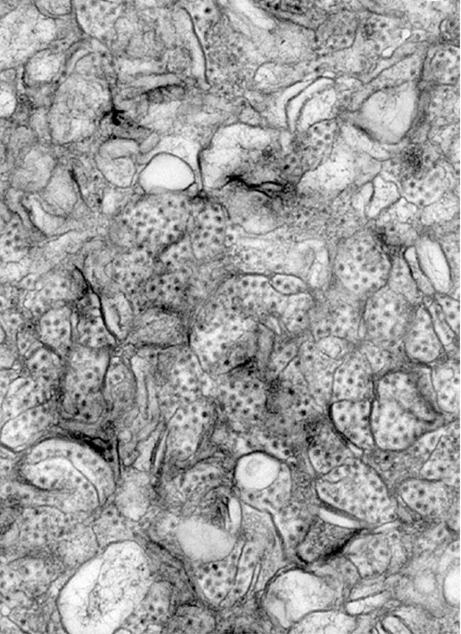 The first norovirus cell culture system