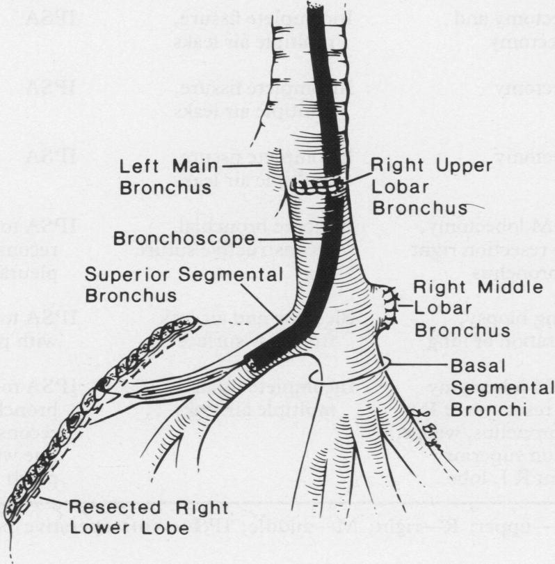 graphic file with name thorax00345-0025-a.jpg