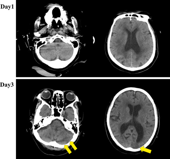 Fig. 2