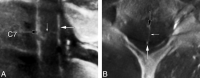 Fig 6.