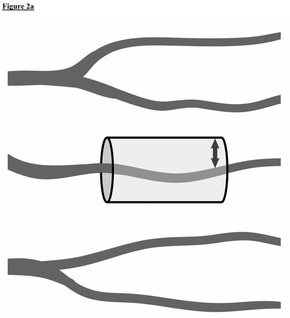 Figure 2A and 2B