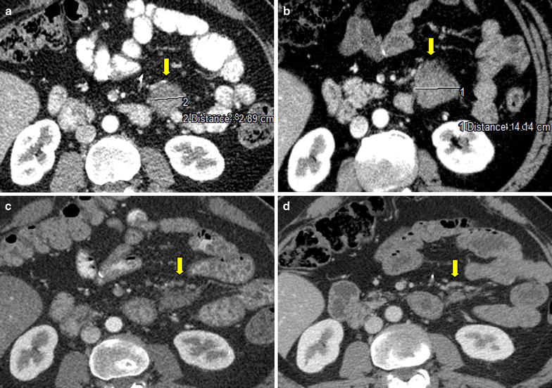 Fig. 3