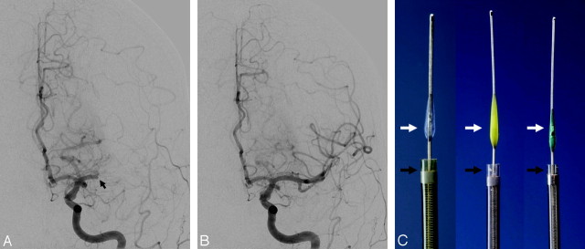 Fig 4.