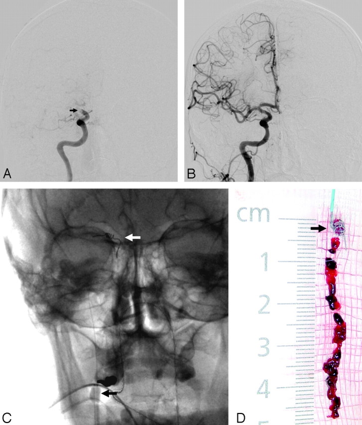 Fig 2.