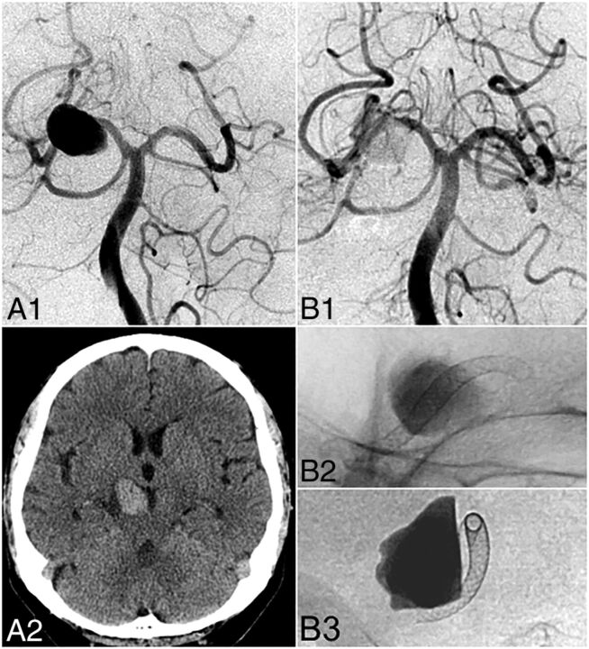 Fig 1.