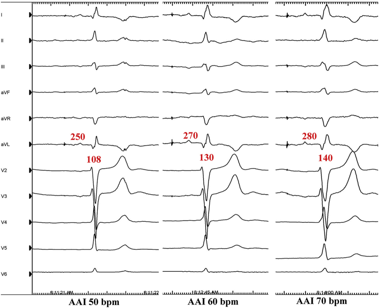 Supplemental Figure 1