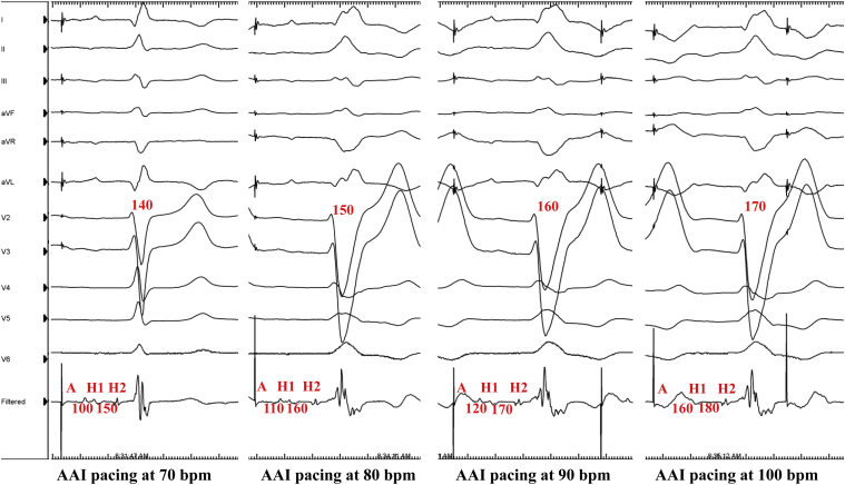 Figure 3