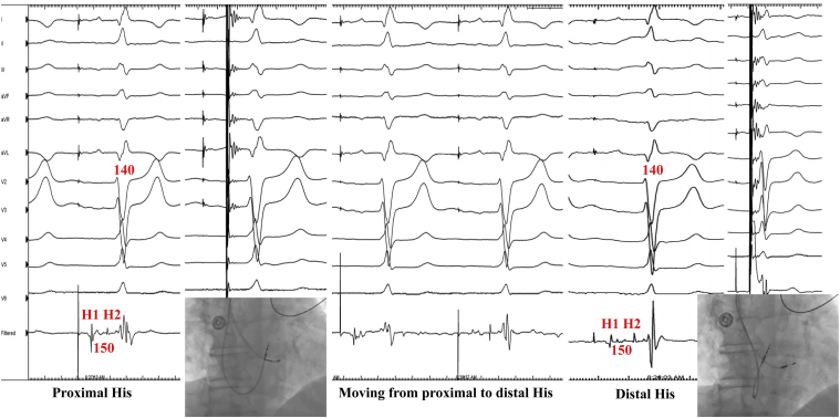 Figure 2