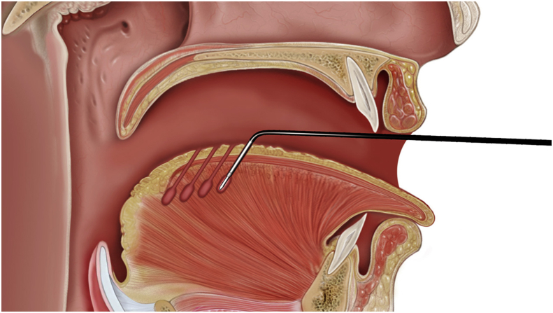 Fig. 6