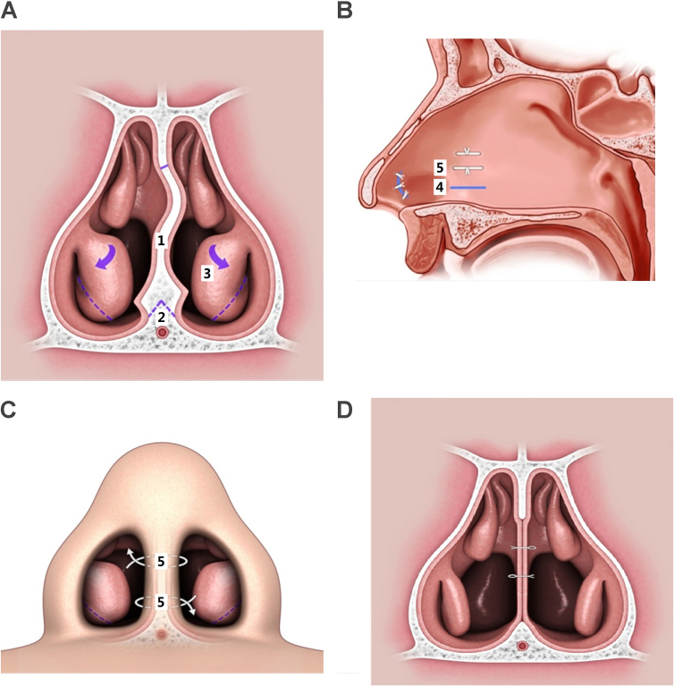 Fig. 3