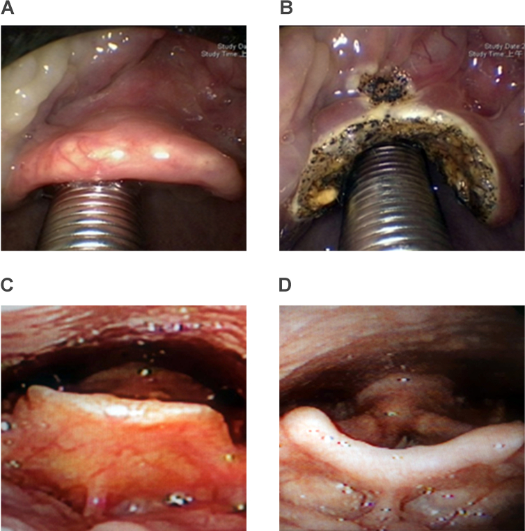 Fig. 7