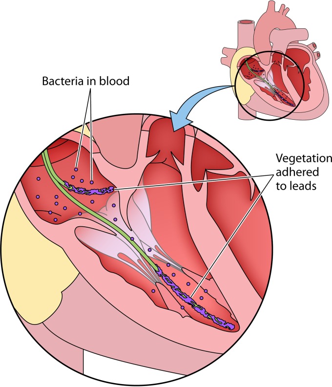 FIG 2