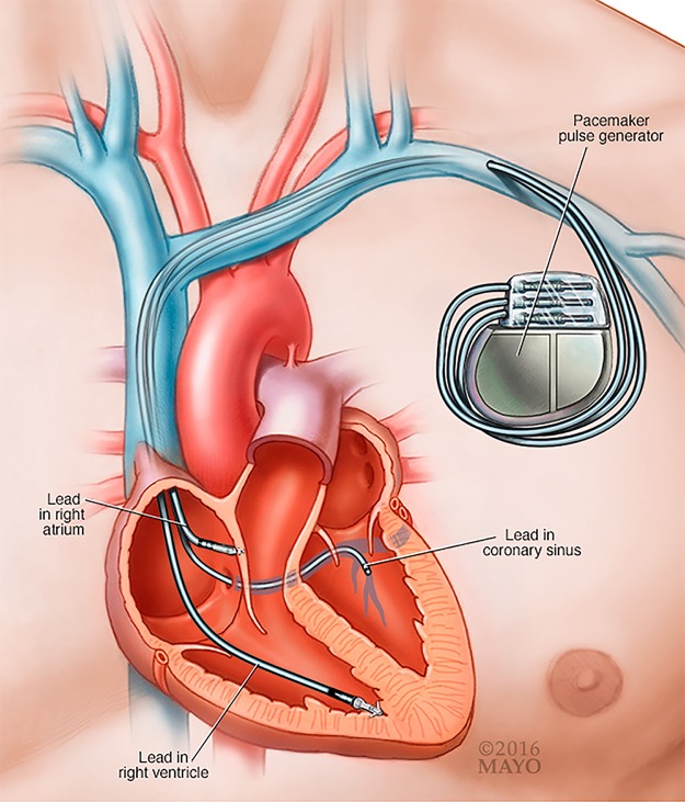 FIG 1