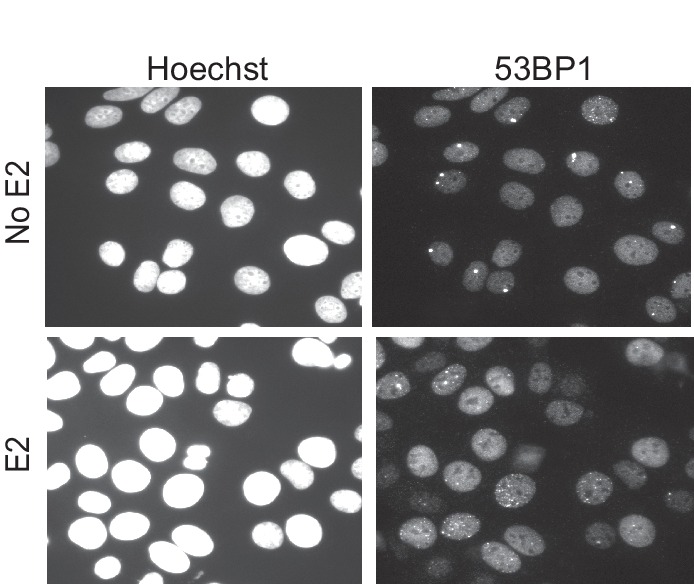 Figure 1—figure supplement 1.