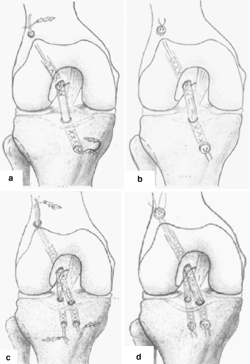 Fig. 1