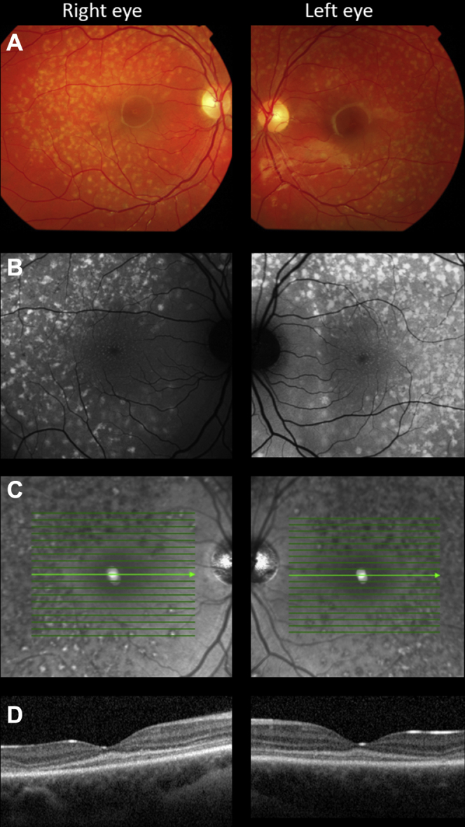 Figure 2