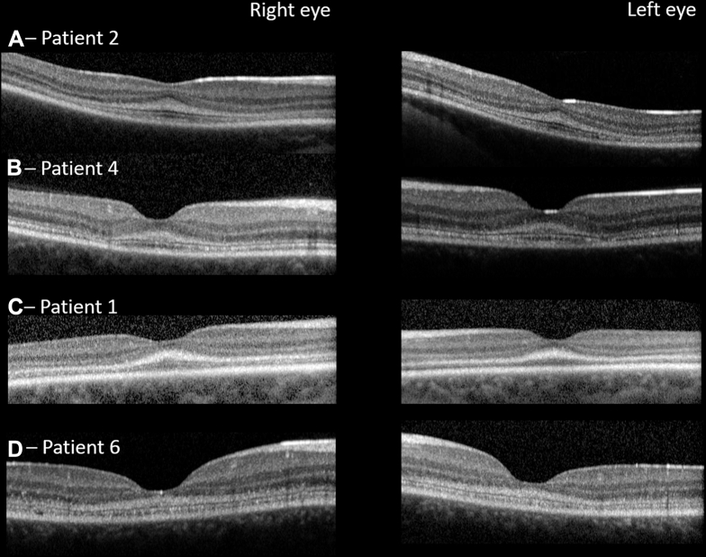 Figure 3